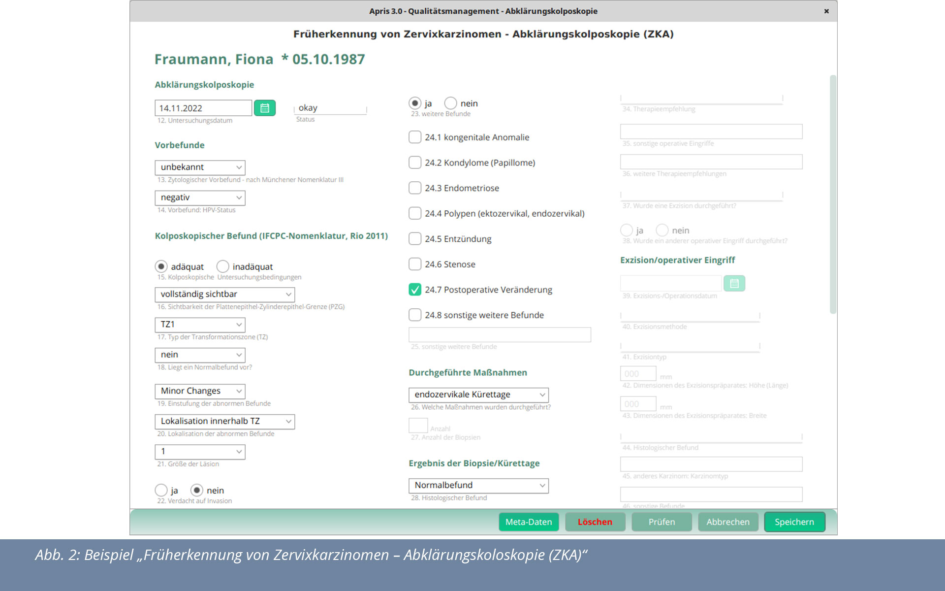 Beispiel: Apris-Praxissoftware Zervixkarzinom