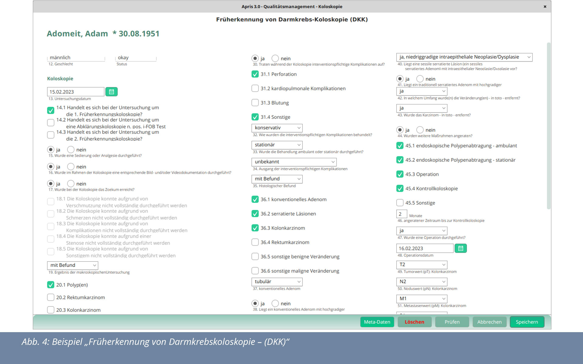 Beispiel: Apris-Praxissoftware Darmkrebs-Koloskopie